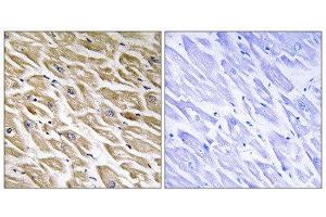 Immunohistochemistry (IHC) image for anti-Mitochondrial Ribosomal Protein L39 (MRPL39) (C-Term) antibody (ABIN1851576) (MRPL39 anticorps  (C-Term))
