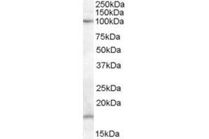 Western Blotting (WB) image for anti-Membrane-Associated Ring Finger (C3HC4) 6, E3 Ubiquitin Protein Ligase (MARCH6) (AA 701-712) antibody (ABIN303916)