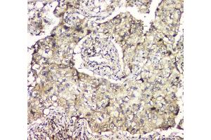 IHC analysis of MCUR1 using anti-MCUR1 antibody (ABIN6719261).
