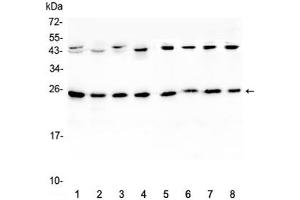 Western blot testing of 1) rat brain, 2) rat lung, 3) mouse brain, 4) mouse lung and human 5) HeLa, 6) placenta, 7) MCF7 and 8) HepG2 lystate with IL36A antibody at 0. (IL36A/IL1F6 anticorps  (AA 6-151))