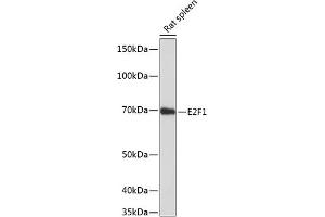 Western blot analysis of extracts of rat spleen, using E2F1 antibody (ABIN7266873) at 1:1000 dilution. (E2F1 anticorps)