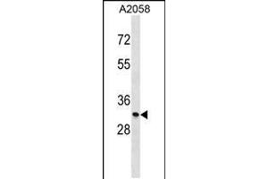Western blot analysis in A2058 cell line lysates (35ug/lane). (MGLL anticorps  (N-Term))
