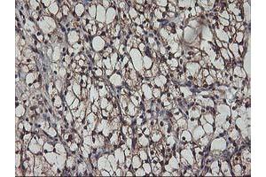 Image no. 2 for anti-V-Akt Murine Thymoma Viral Oncogene Homolog 1 (AKT1) antibody (ABIN1496554) (AKT1 anticorps)