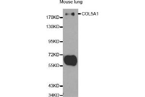 Western blot analysis of extracts of mouse lung, using COL5A1 antibody (ABIN5970709) at 1/500 dilution. (COL5A1 anticorps)