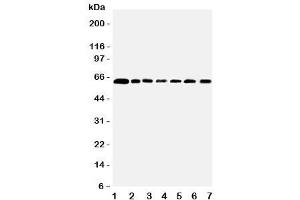 Western blot testing of PRMT4 antibody and Lane 1:  rat spleen (CARM1 anticorps  (Middle Region))