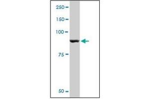 Western Blotting (WB) image for anti-Phosphorylase, Glycogen, Muscle (PYGM) antibody (ABIN952549)