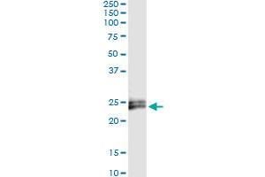 Immunoprecipitation of IFNE transfected lysate using anti-IFNE monoclonal antibody and Protein A Magnetic Bead , and immunoblotted with IFNE MaxPab rabbit polyclonal antibody.
