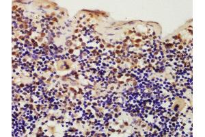 Formalin-fixed and paraffin embedded mouse spleen labeled with Rabbit Anti-IKIP Polyclonal Antibody, Unconjugated (ABIN872858) at 1:200 followed by conjugation to the secondary antibody and DAB staining (IKbIP anticorps  (AA 250-350))
