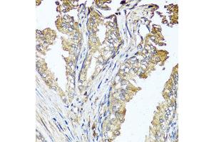 Immunohistochemistry of paraffin-embedded human prostate using STK3 antibody at dilution of 1:100 (x40 lens).