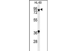 Western blot analysis of TL1 Antibody (C-term) (ABIN653753 and ABIN2843053) in HL-60 cell line lysates (35 μg/lane). (PATL1 anticorps  (C-Term))