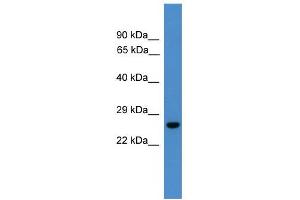 WB Suggested Anti-UCHL3 Antibody Titration: 0. (UCHL3 anticorps  (C-Term))