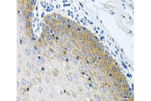 Immunohistochemistry of paraffin-embedded Human esophagus using GNE Polyclonal Antibody at dilution of 1:100 (40x lens). (GNE anticorps)