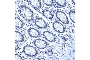 Immunohistochemistry of paraffin-embedded human colon using CDC40 Rabbit mAb (ABIN7266255) at dilution of 1:100 (40x lens). (CDC40 anticorps)