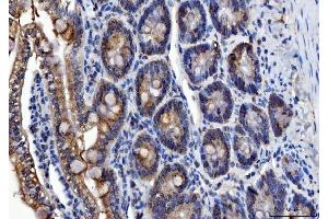 IHC analysis of ALDH1B1 using anti-ALDH1B1 antibody (ABIN4886450).