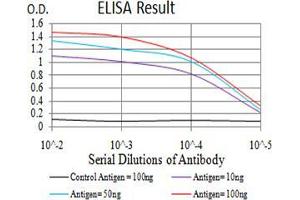 Black line: Control Antigen (100 ng);Purple line: Antigen (10ng); Blue line: Antigen (50 ng); Red line:Antigen (100 ng)