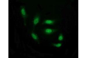 Image no. 6 for anti-THUMP Domain Containing 1 (THUMPD1) antibody (ABIN1501384) (THUMPD1 anticorps)