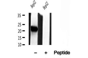 Western blot analysis of extracts of HepG2 cells, using Tim23 antibody. (TIMM23 anticorps  (N-Term))