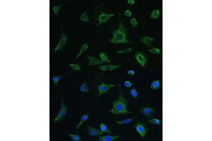 Immunofluorescence analysis of L-929 cells using Oncostatin M antibody (ABIN6128404, ABIN6145072, ABIN6145073 and ABIN6221768) at dilution of 1:100.
