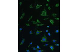 Immunofluorescence analysis of L-929 cells using Oncostatin M antibody (ABIN6128404, ABIN6145072, ABIN6145073 and ABIN6221768) at dilution of 1:100. (Oncostatin M anticorps  (AA 26-252))