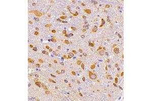 Immunohistochemistry of paraffin embedded mouse epencephalon using CRMP3 (ABIN7073734) at dilution of 1:650 (400x lens)