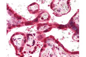 Anti-SLC9A3R1 / NHERF1 antibody IHC of human placenta.