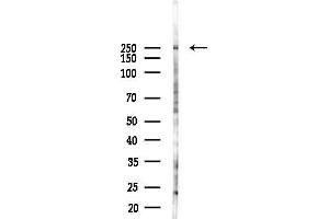 Western blot analysis of lysates from PC12 cells(LPS 4h treatment), using Collagen V alpha 1 Antibody at 1/1000 dilution.