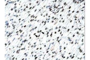 Image no. 3 for anti-Homeobox B9 (HOXB9) (AA 67-116) antibody (ABIN6735813)