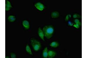 Immunofluorescent analysis of MCF-7 cells using ABIN7144021 at dilution of 1:100 and Alexa Fluor 488-congugated AffiniPure Goat Anti-Rabbit IgG(H+L) (AMPD2 anticorps  (AA 1-129))