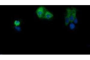 Image no. 5 for anti-Phosphoinositide-3-Kinase, Catalytic, gamma Polypeptide (PIK3CG) antibody (ABIN1500203)