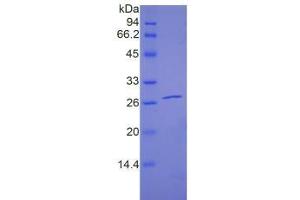 SDS-PAGE of Protein Standard from the Kit (Highly purified E. (PAPPA2 Kit ELISA)