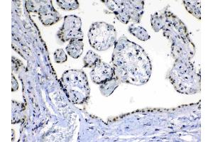 IHC analysis of MED15 using anti-MED15 antibody .