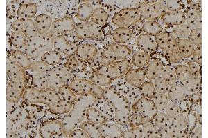 ABIN6277648 at 1/100 staining Rat kidney tissue by IHC-P. (CRYbB2 anticorps  (Internal Region))