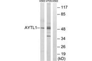 Western Blotting (WB) image for anti-Lysophosphatidylcholine Acyltransferase 2 (LPCAT2) (AA 321-370) antibody (ABIN2890096) (LPCAT2 anticorps  (AA 321-370))