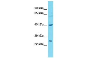 Host:  Rabbit  Target Name:  Tfdp2  Sample Type:  Rat Stomach lysates  Antibody Dilution:  1. (DP2 anticorps  (N-Term))