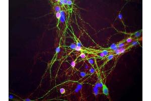 Mixed neuron-glial cultures stained with ABIN1580411, our monoclonal antibody to α-synuclein (red) and chicken polyclonal antibody to MAP2 CPCA-MAP2 (green).