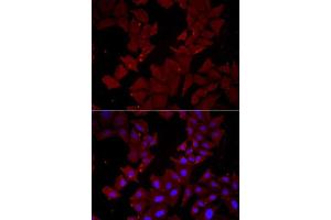 Immunofluorescence analysis of HeLa cells using CCT4 antibody.