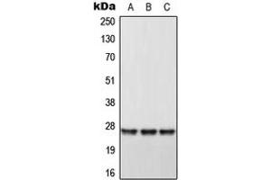 Western blot analysis of DHRS2 expression in HeLa (A), Raw264. (DHRS2 anticorps  (Center))
