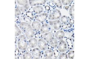 Immunohistochemistry of paraffin-embedded mouse kidney using SSN Rabbit pAb (3377) at dilution of 1:100 (40x lens). (SSNA1 anticorps  (AA 1-119))