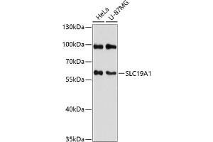 Western blot analysis of extracts of various cell lines, using SLC19 antibody (2819) at 1:3000 dilution.