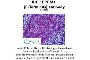 Image no. 1 for anti-FRAS1 Related Extracellular Matrix 1 (FREM1) (C-Term) antibody (ABIN1734463)