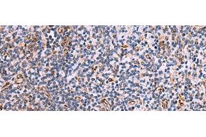 Immunohistochemistry of paraffin-embedded Human tonsil tissue using ITGA11 Polyclonal Antibody at dilution of 1:75(x200)