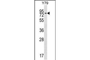 Western blot analysis in Y79 cell line lysates (35ug/lane). (MAK anticorps  (C-Term))