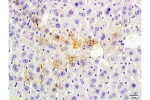 Formalin-fixed and paraffin embedded rat liver tissue labeled with Anti-Tsg101 Polyclonal Antibody , Unconjugated at 1:200 followed by conjugation to the secondary antibody, (SP-0023), and DAB staining