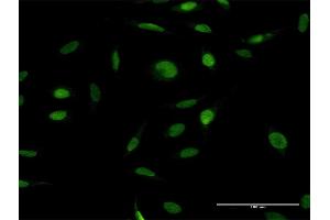 Immunofluorescence of purified MaxPab antibody to ZFP42 on HeLa cell. (ZFP42 anticorps  (AA 1-310))