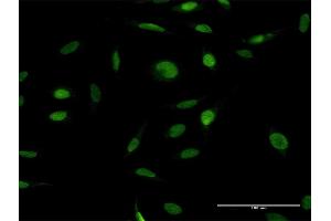 Immunofluorescence of purified MaxPab antibody to ZFP42 on HeLa cell.
