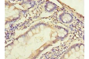 Immunohistochemistry of paraffin-embedded human small intestine tissue using ABIN7169964 at dilution of 1:100 (SLC38A2 anticorps  (AA 1-76))