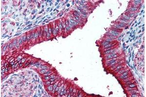 Human Uterus (formalin-fixed, paraffin-embedded) stained with FUT4 antibody ABIN297072 at 1:50 followed by biotinylated anti-mouse IgG secondary antibody ABIN481714, alkaline phosphatase-streptavidin and chromogen. (CD15 anticorps)