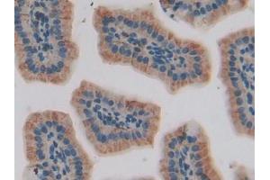DAB staining on IHC-P; Samples: Mouse Small intestine Tissue (IGFBP5 anticorps  (AA 25-271))