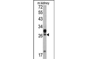 Western blot analysis of HOXA5 antibody (C-term ) (ABIN390648 and ABIN2840947) in mouse kidney tissue lysates (35 μg/lane). (HOXA5 anticorps  (C-Term))