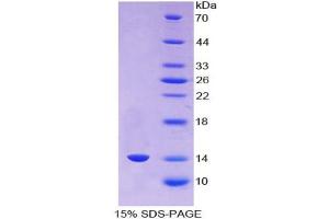 SDS-PAGE analysis of Human AGGF1 Protein. (AGGF1 Protéine)